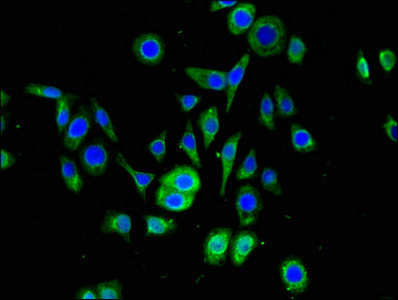 SNRPD1 Antibody in Immunocytochemistry (ICC/IF)