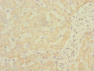 SOAT2 Antibody in Immunohistochemistry (Paraffin) (IHC (P))