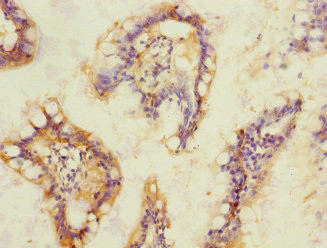 SOAT2 Antibody in Immunohistochemistry (Paraffin) (IHC (P))