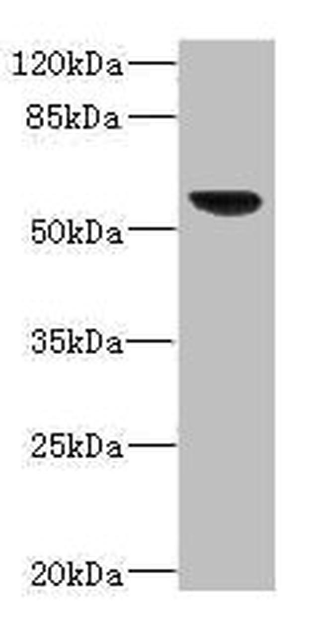 SOAT2 Antibody in Western Blot (WB)