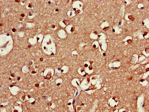 SRR Antibody in Immunohistochemistry (Paraffin) (IHC (P))