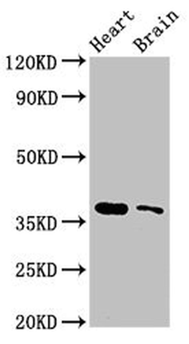 SRR Antibody in Western Blot (WB)