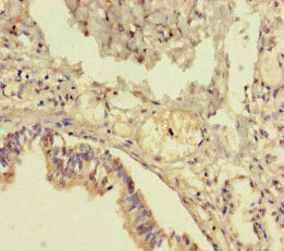 TMEM64 Antibody in Immunohistochemistry (Paraffin) (IHC (P))