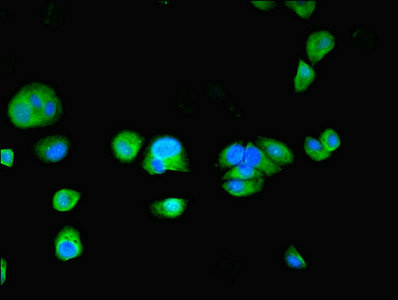 TPPP2 Antibody in Immunocytochemistry (ICC/IF)