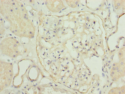 TPPP2 Antibody in Immunohistochemistry (Paraffin) (IHC (P))