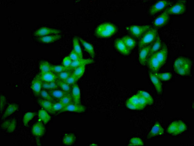 ZNF703 Antibody in Immunocytochemistry (ICC/IF)