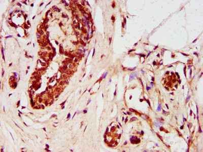 ZNF703 Antibody in Immunohistochemistry (Paraffin) (IHC (P))