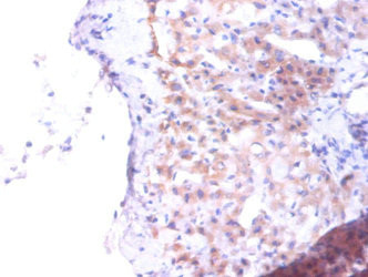 PTDSS1 Antibody in Immunohistochemistry (Paraffin) (IHC (P))