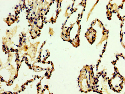 DKK2 Antibody in Immunohistochemistry (Paraffin) (IHC (P))