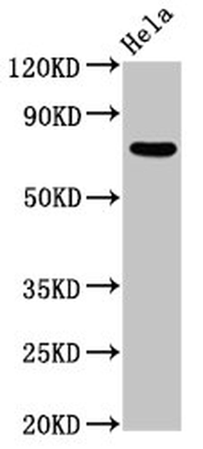 MTMR2 Antibody in Western Blot (WB)