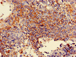 MAN2A1 Antibody in Immunohistochemistry (Paraffin) (IHC (P))