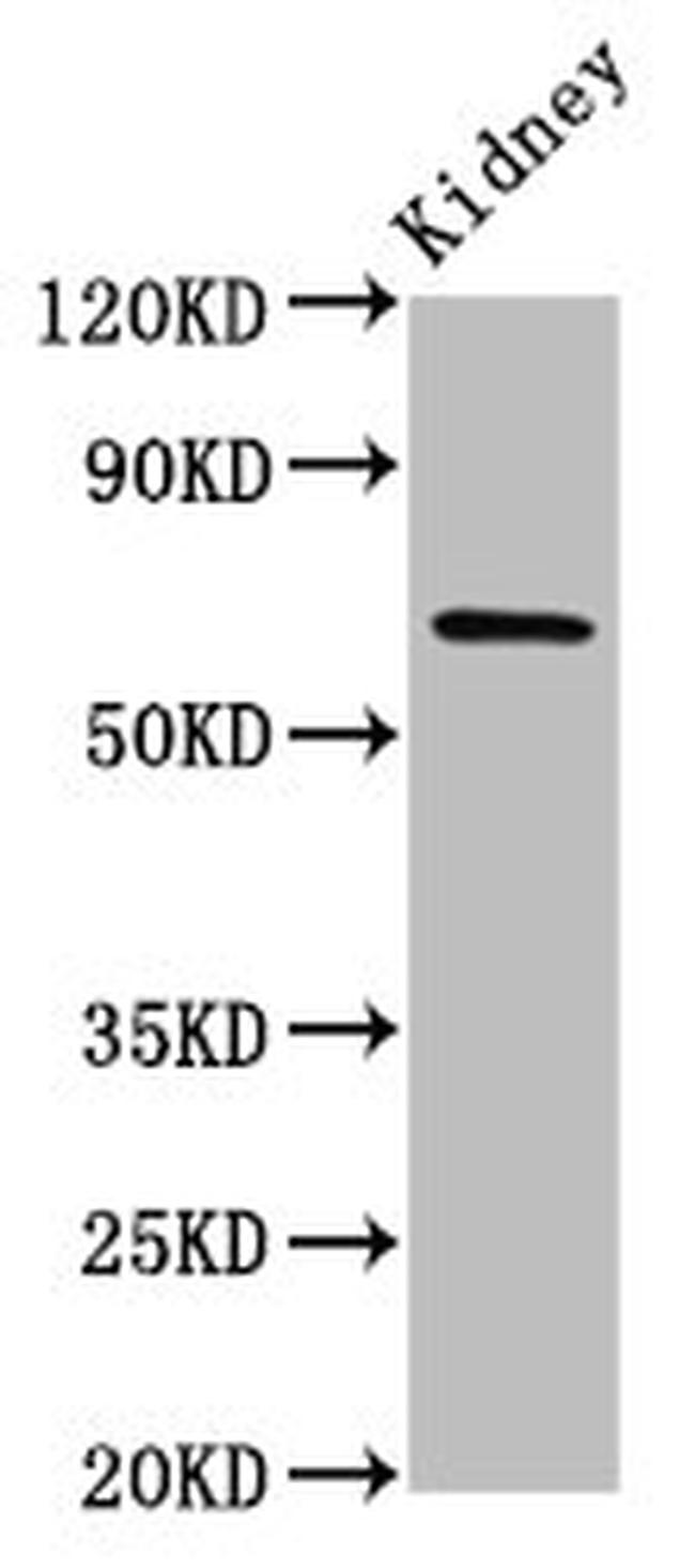 TNIP1 Antibody in Western Blot (WB)