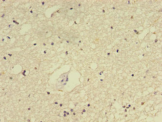 E2F2 Antibody in Immunohistochemistry (Paraffin) (IHC (P))