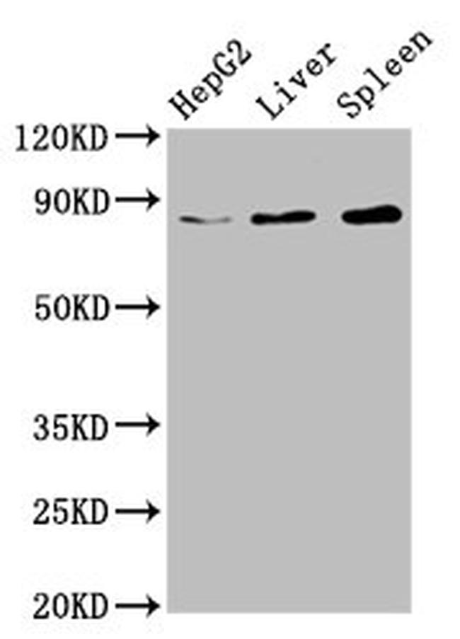 NSUN2 Antibody in Western Blot (WB)