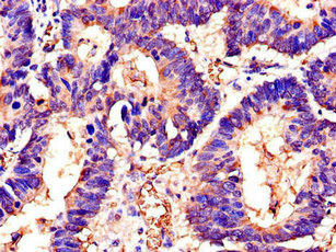 SWI5 Antibody in Immunohistochemistry (Paraffin) (IHC (P))