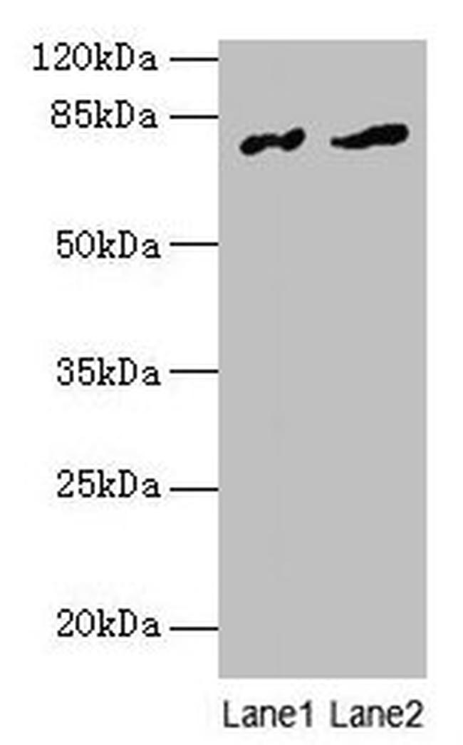 FAM161A Antibody in Western Blot (WB)