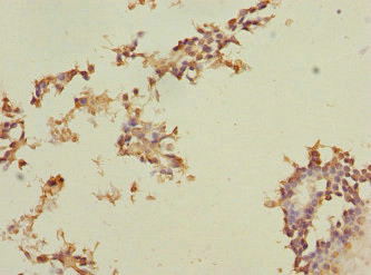 MEST Antibody in Immunohistochemistry (Paraffin) (IHC (P))