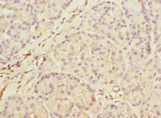 MEST Antibody in Immunohistochemistry (Paraffin) (IHC (P))