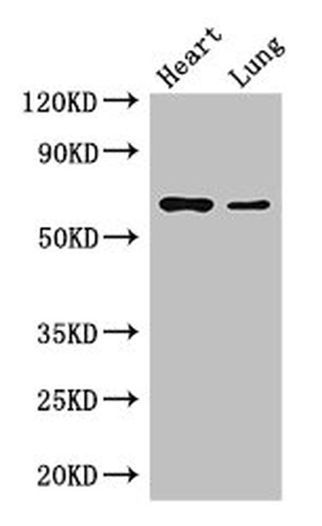 DCAF8 Antibody in Western Blot (WB)