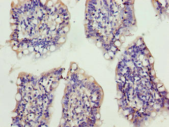 XRRA1 Antibody in Immunohistochemistry (Paraffin) (IHC (P))