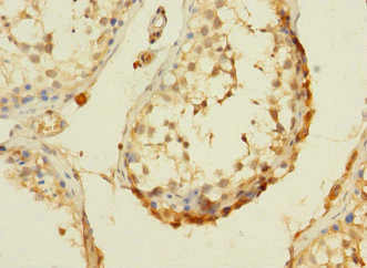 DHX32 Antibody in Immunohistochemistry (Paraffin) (IHC (P))