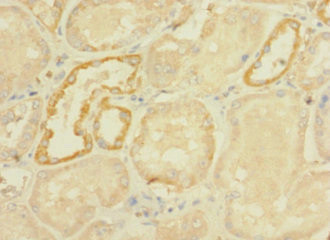 DHX32 Antibody in Immunohistochemistry (Paraffin) (IHC (P))