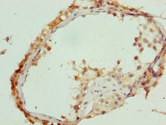 C17orf64 Antibody in Immunohistochemistry (Paraffin) (IHC (P))