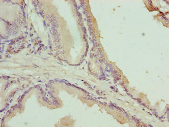 C17orf64 Antibody in Immunohistochemistry (Paraffin) (IHC (P))