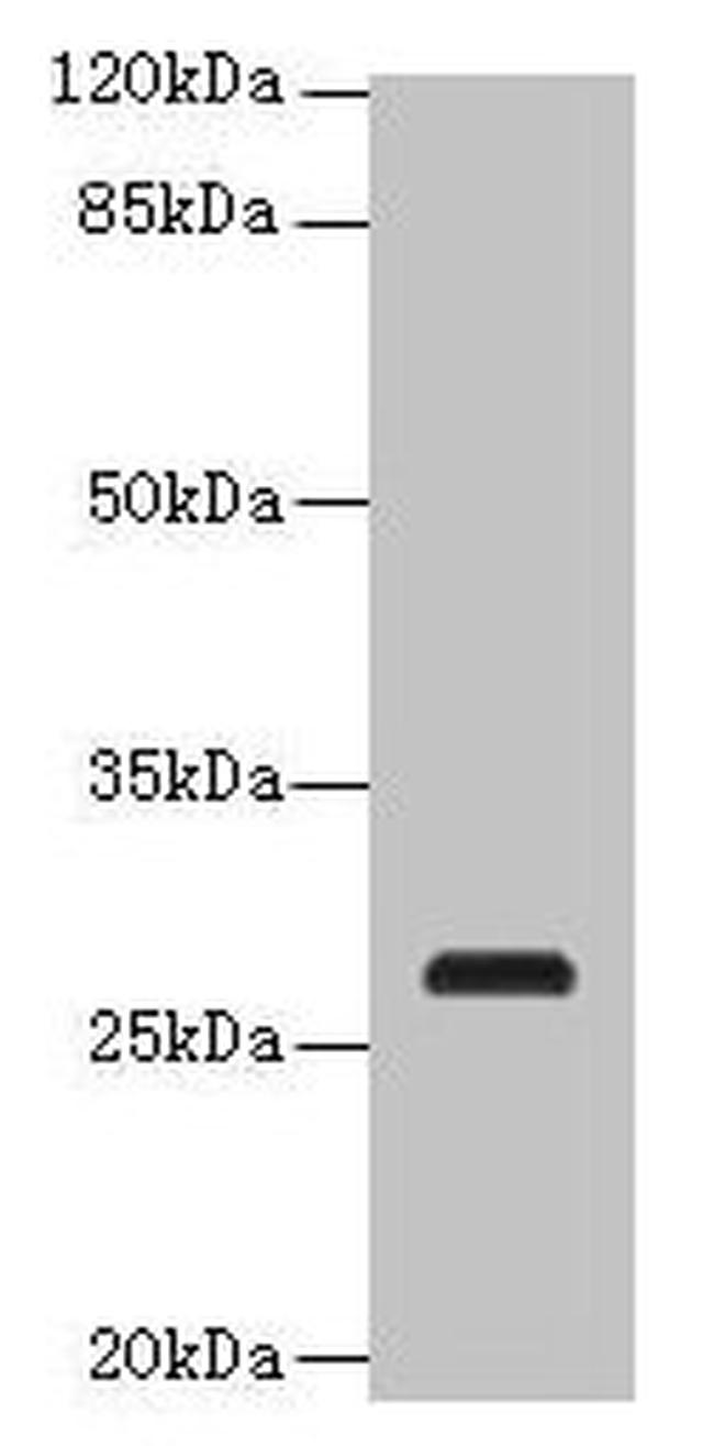 C17orf64 Antibody in Western Blot (WB)