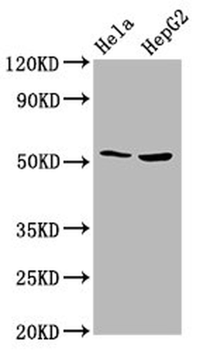 THNSL2 Antibody in Western Blot (WB)