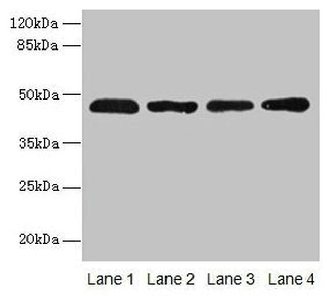 ZDHHC23 Antibody in Western Blot (WB)