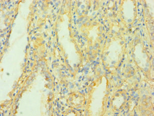 MCPH1 Antibody in Immunohistochemistry (Paraffin) (IHC (P))