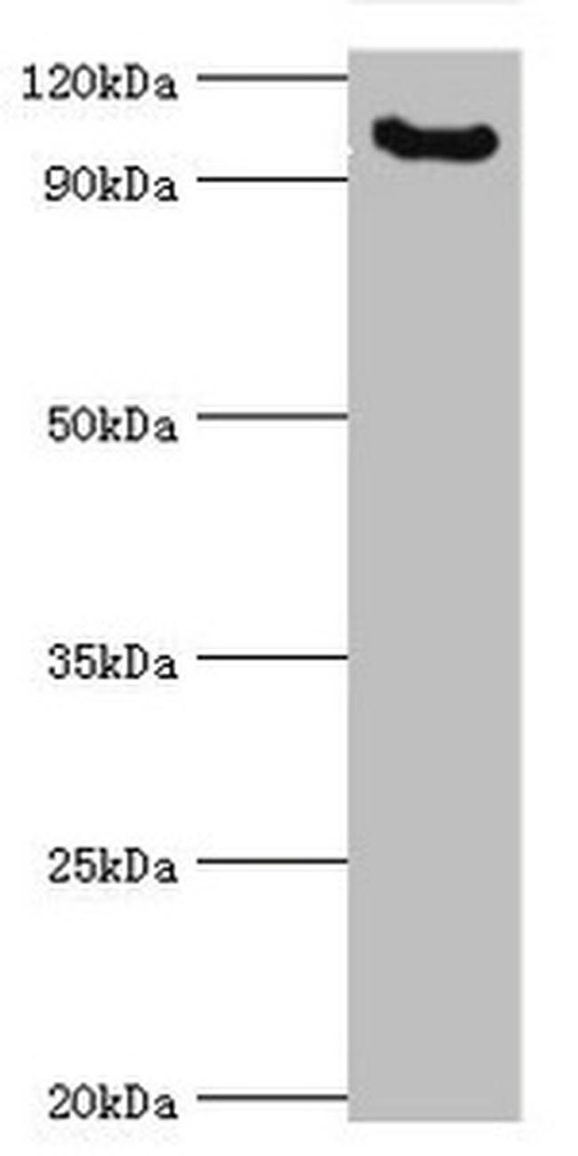 MCPH1 Antibody in Western Blot (WB)