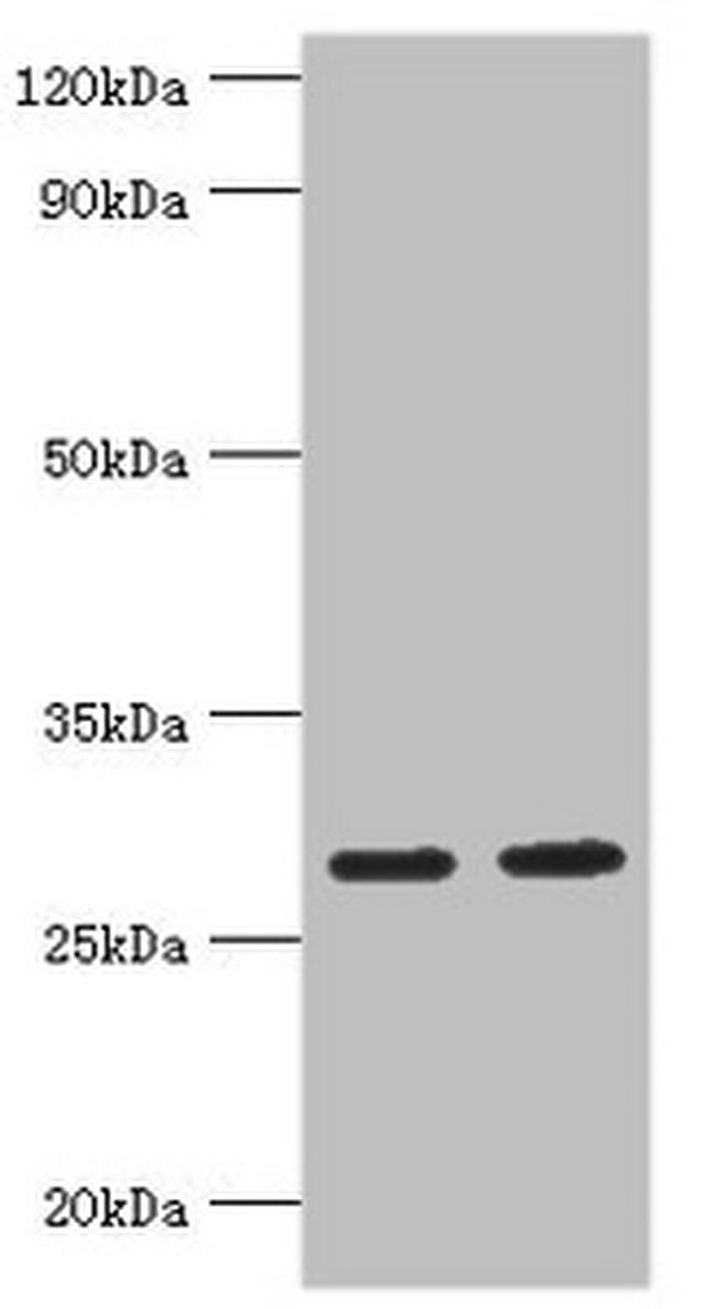 UBE2J2 Antibody in Western Blot (WB)