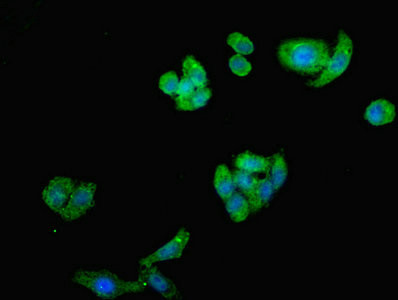 ST8SIA2 Antibody in Immunocytochemistry (ICC/IF)