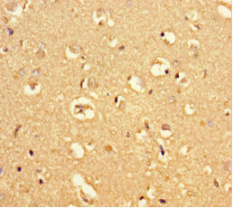 MRAP2 Antibody in Immunohistochemistry (Paraffin) (IHC (P))