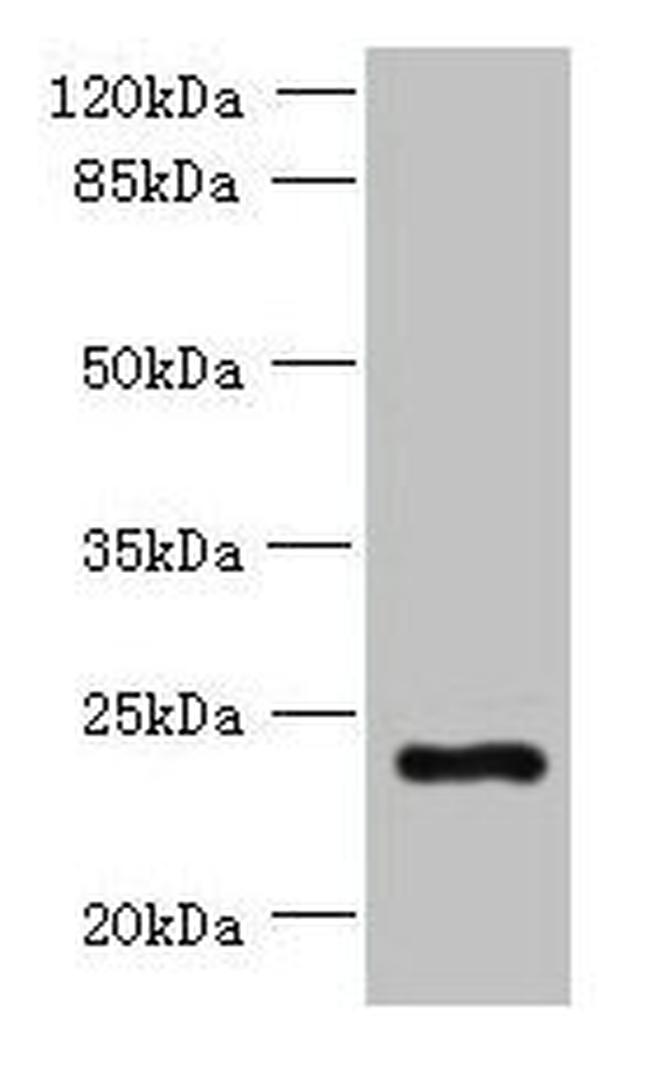 PQLC3 Antibody in Western Blot (WB)