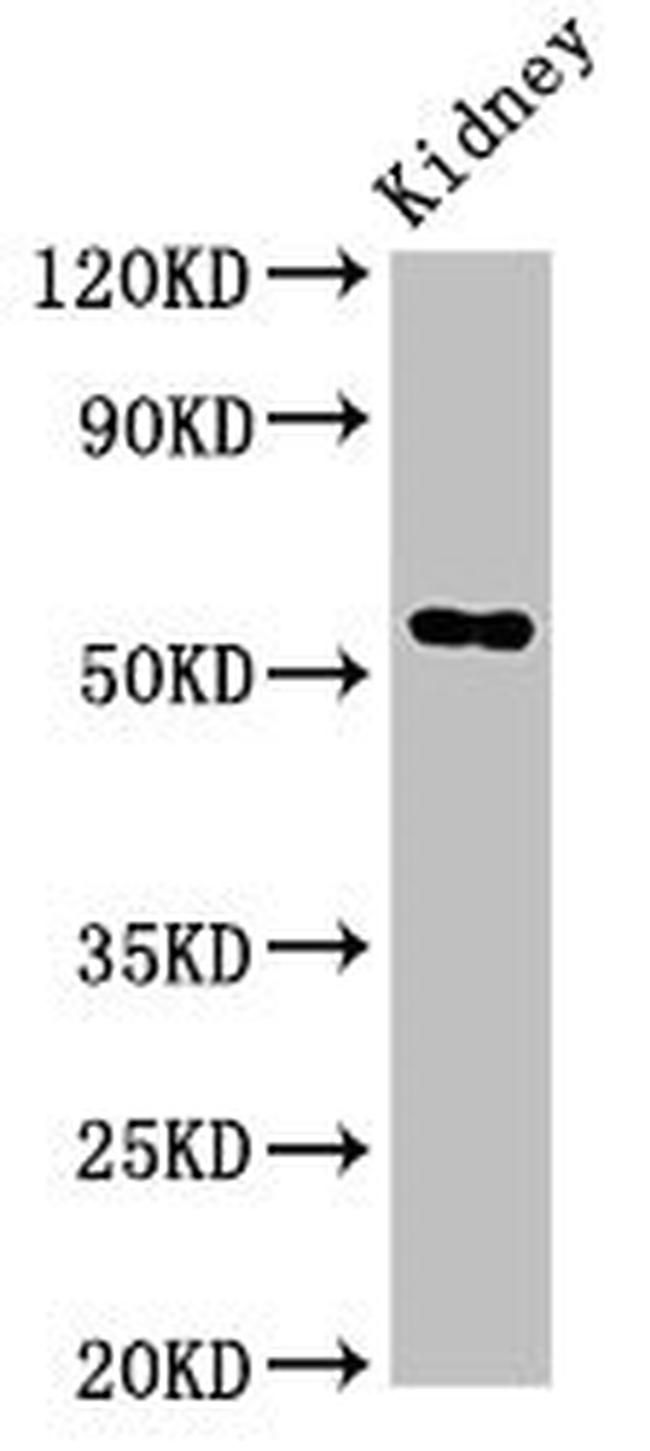 FUCA1 Antibody in Western Blot (WB)