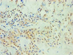 SPIN2 Antibody in Immunohistochemistry (Paraffin) (IHC (P))