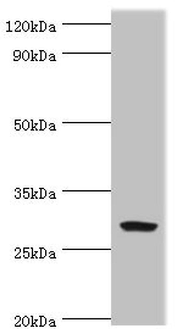 SPIN2 Antibody in Western Blot (WB)