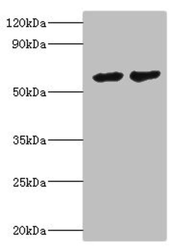 CYP4F12 Antibody in Western Blot (WB)