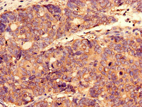 CTPS2 Antibody in Immunohistochemistry (Paraffin) (IHC (P))