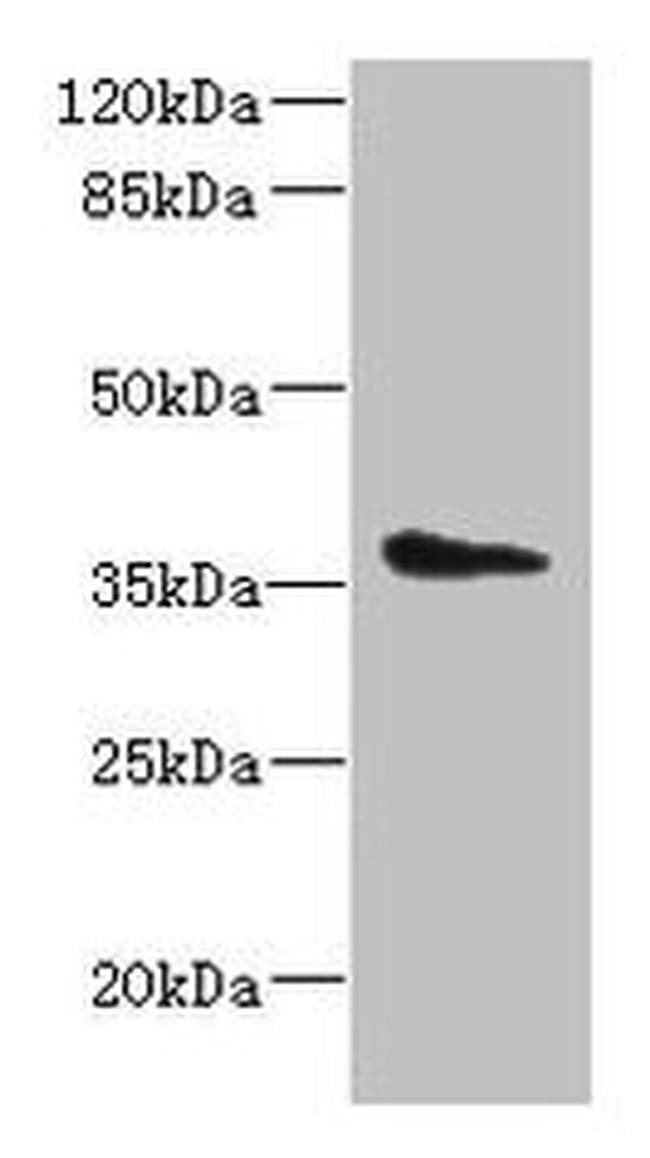 AASDHPPT Antibody in Western Blot (WB)