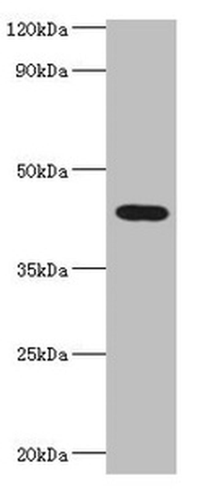 HAUS4 Antibody in Western Blot (WB)