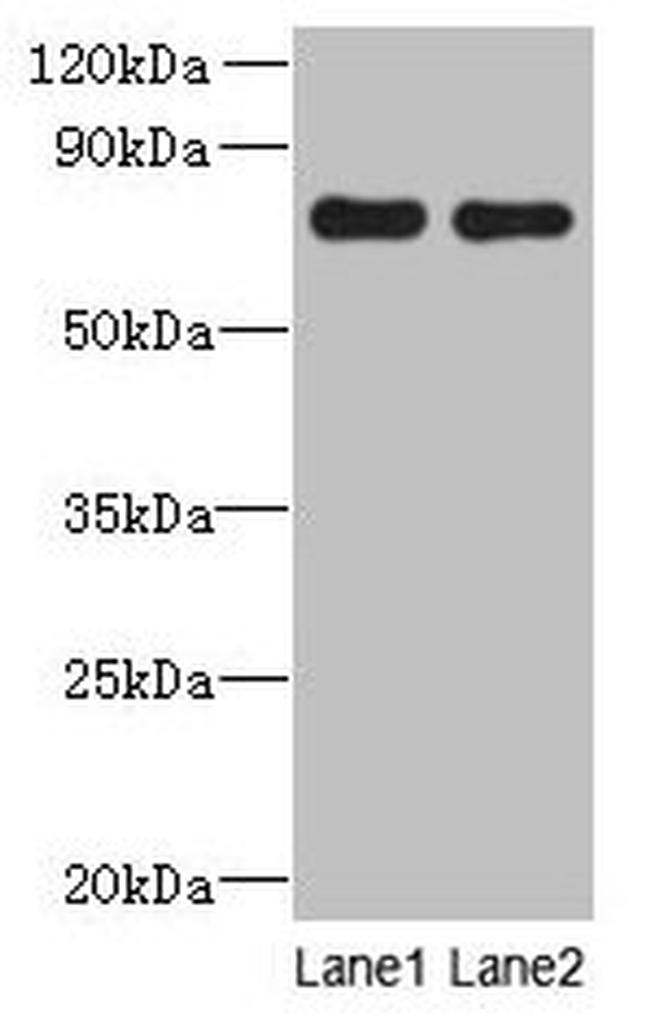 ACTR8 Antibody in Western Blot (WB)