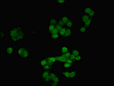 RAVER2 Antibody in Immunocytochemistry (ICC/IF)