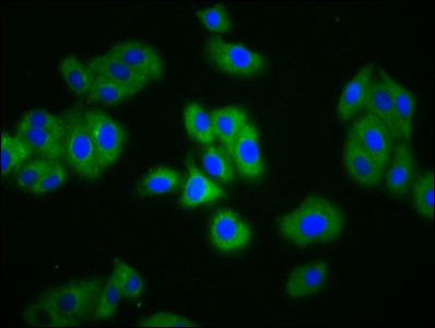 SLC4A5 Antibody in Immunocytochemistry (ICC/IF)