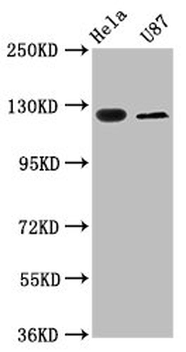 SLC4A5 Antibody in Western Blot (WB)