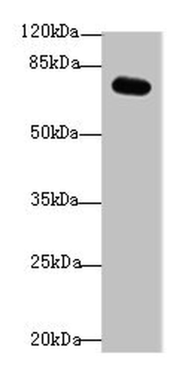 RMI1 Antibody in Western Blot (WB)