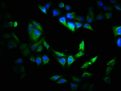 VIPAS39 Antibody in Immunocytochemistry (ICC/IF)